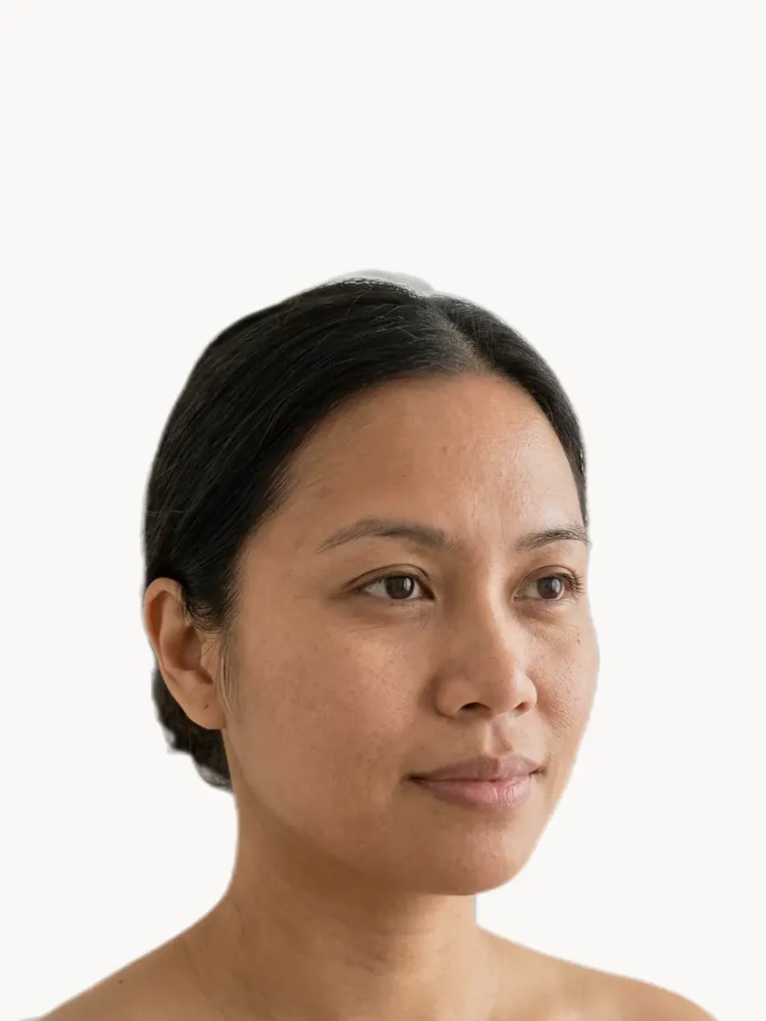 Dehydrated & Dry Skin treatment in Pickering