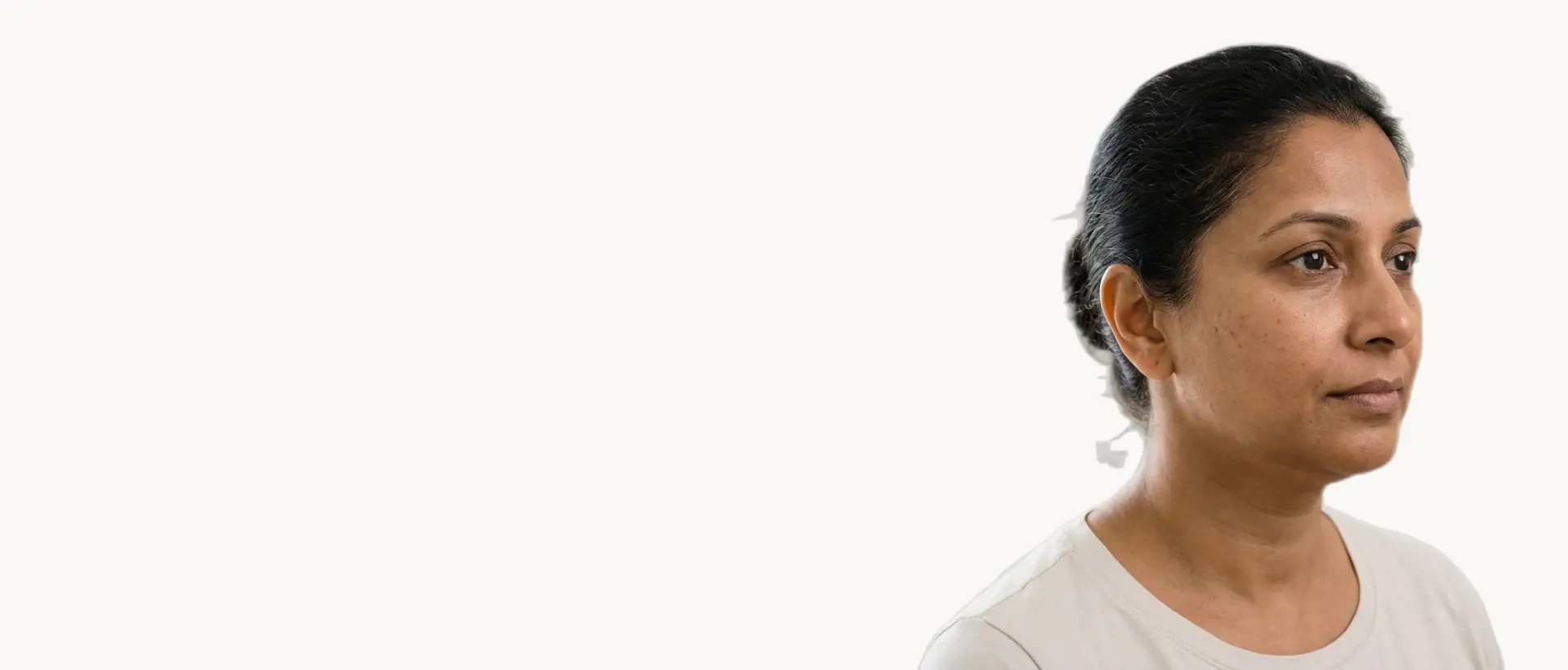 Double Chin treatment in Pickering