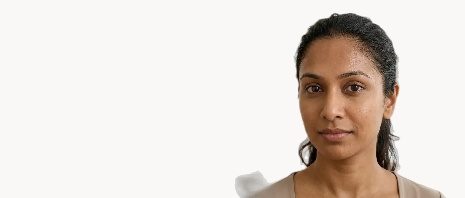 Excessive Sweating treatment in Pickering