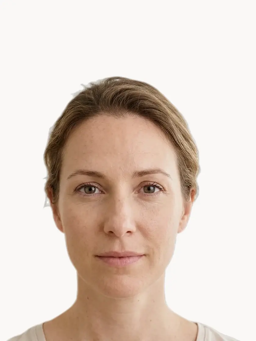 Fine Lines & Wrinkles treatment in Pickering