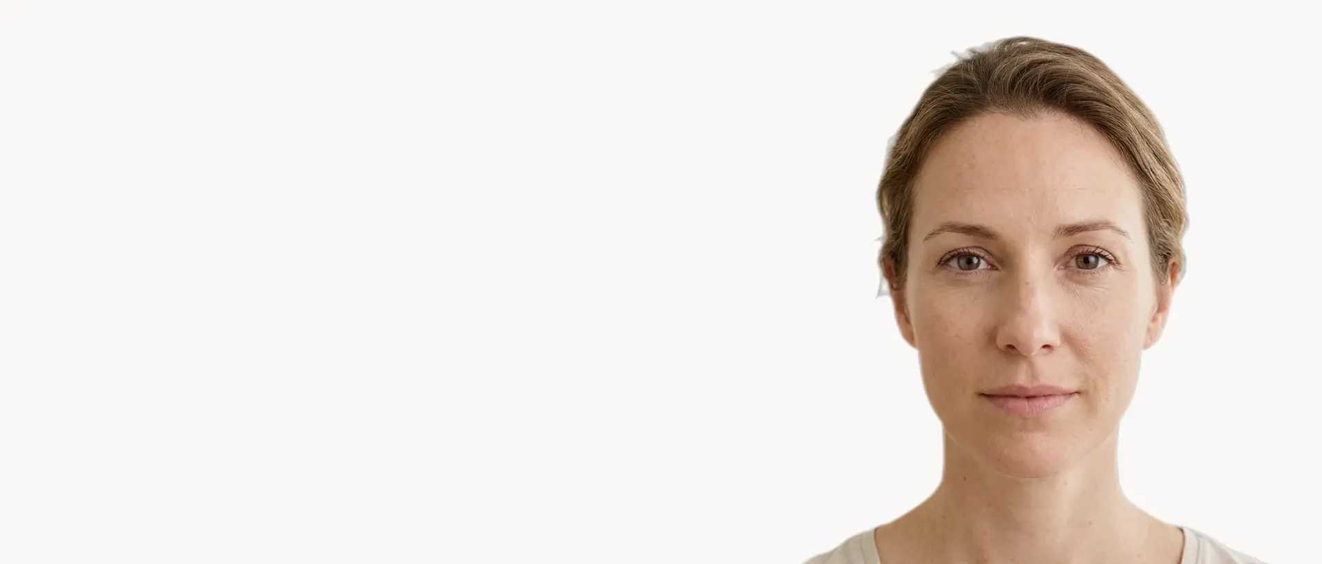 Fine Lines & Wrinkles treatment in Pickering