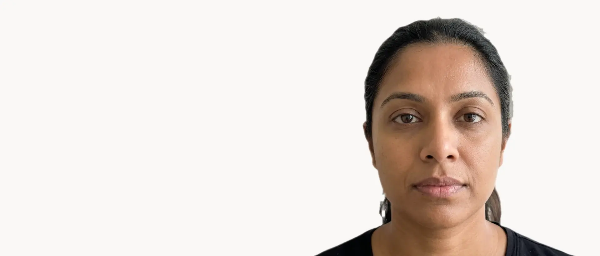 Lip Volume treatment in Pickering