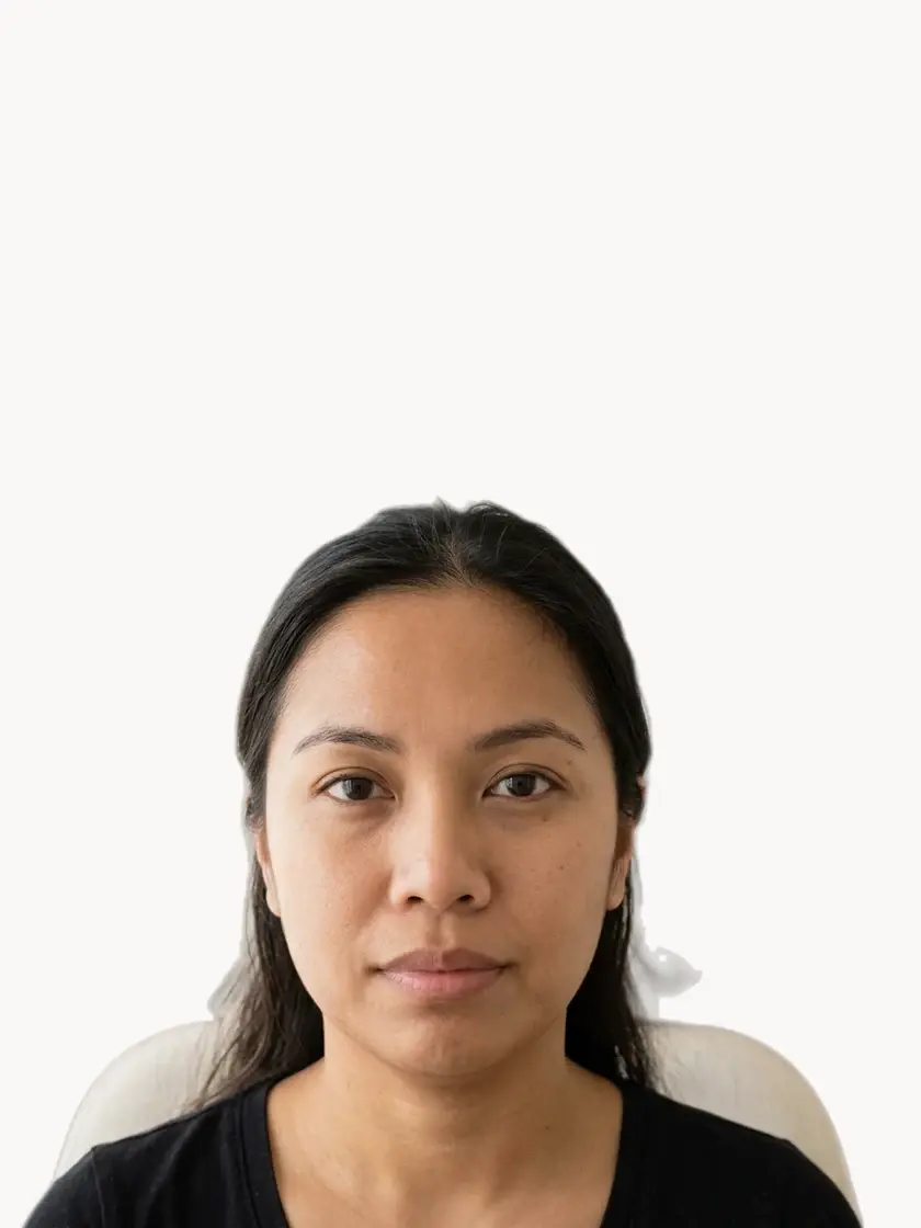 Loose & Sagging Skin treatment in Pickering