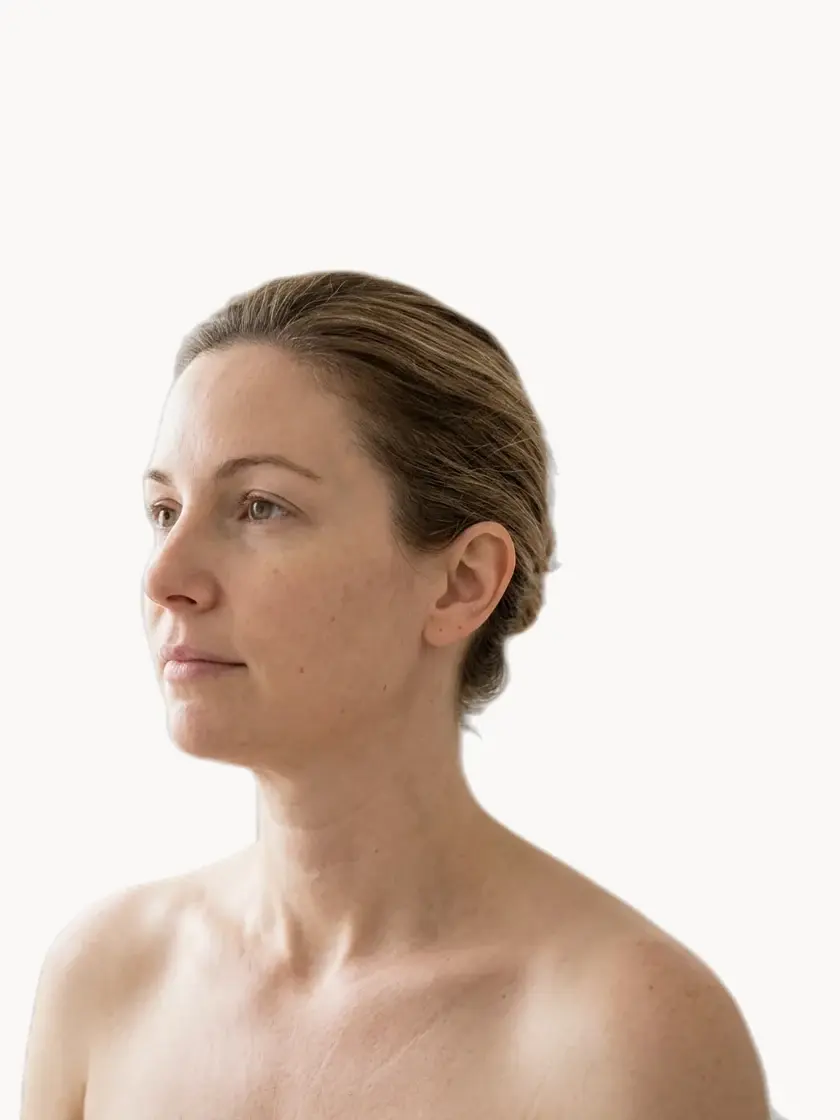 Neck Lines & Tech Neck treatment in Pickering