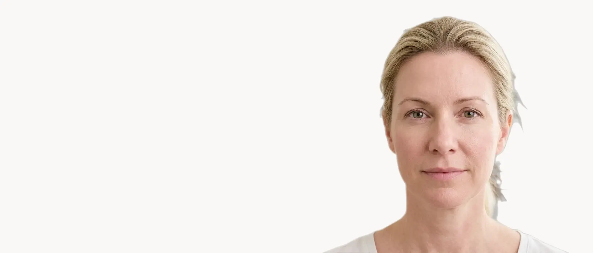 Skin Texture & Enlarged Pores treatment in Pickering