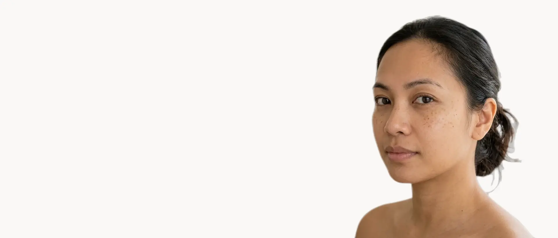 Sun Damage treatment in Pickering
