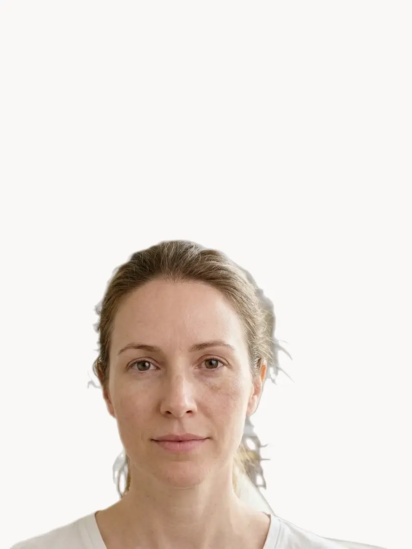 Uneven Skin Tone treatment in Pickering