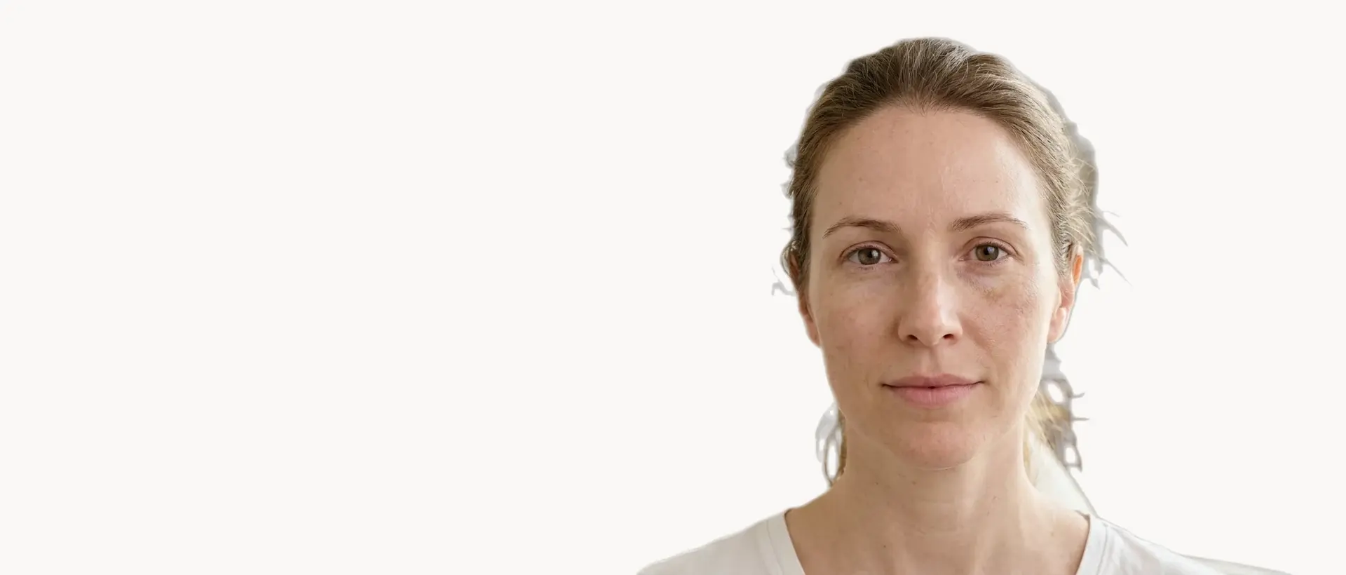 Uneven Skin Tone treatment in Pickering
