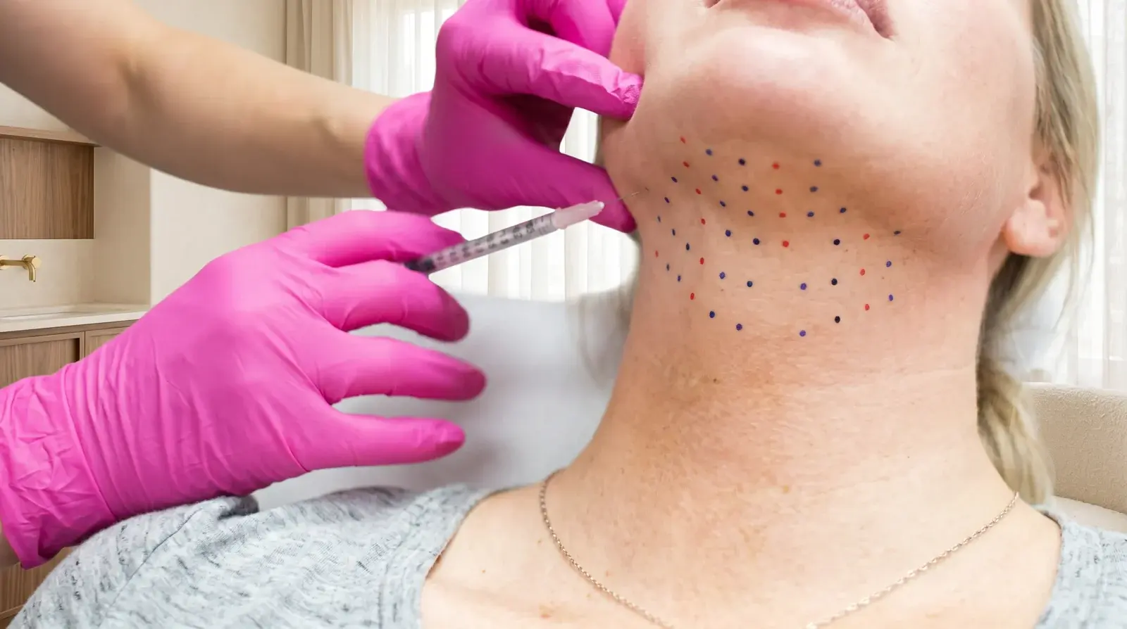 Lipolysis