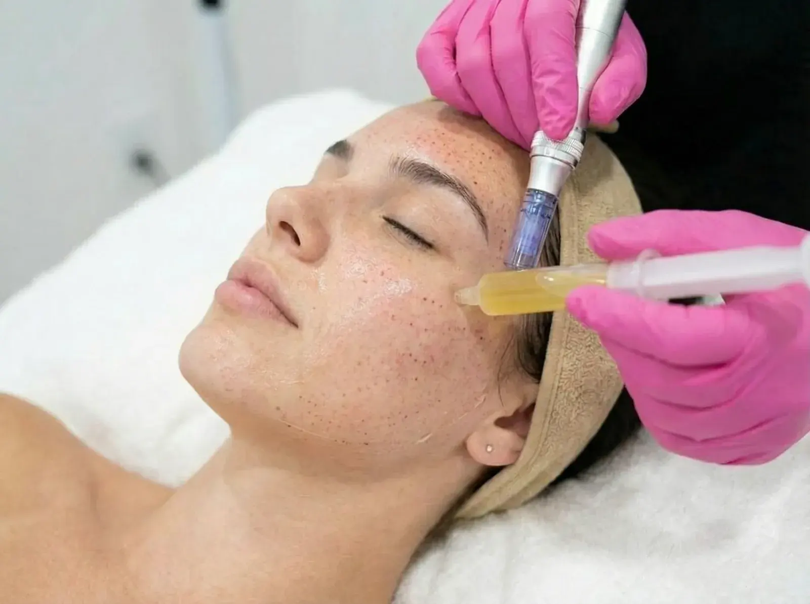 prp vampire facial pickering